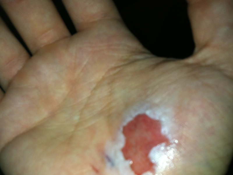 Full sprint slip and fall!